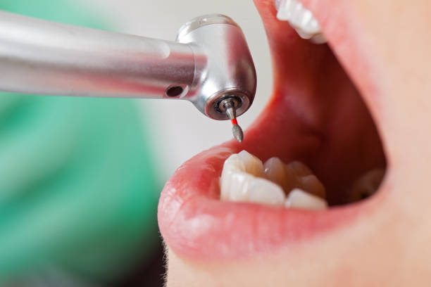 Best Holiday Emergency Dentist in Thorndale, TX